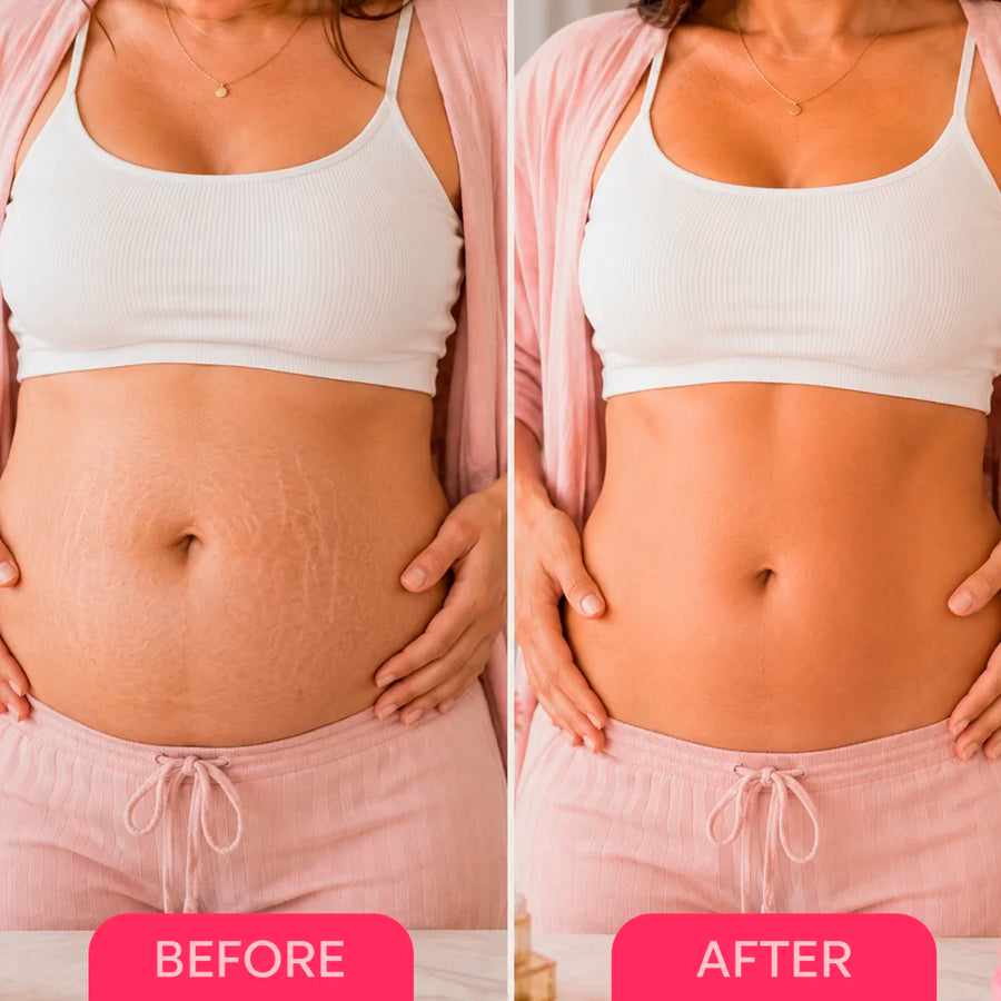 3. Targets Multiple Belly Concerns at Once — Not Just One