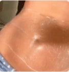 Visibly diminishes the appearance of cellulite - After