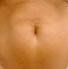 Reduces sagging skin - After