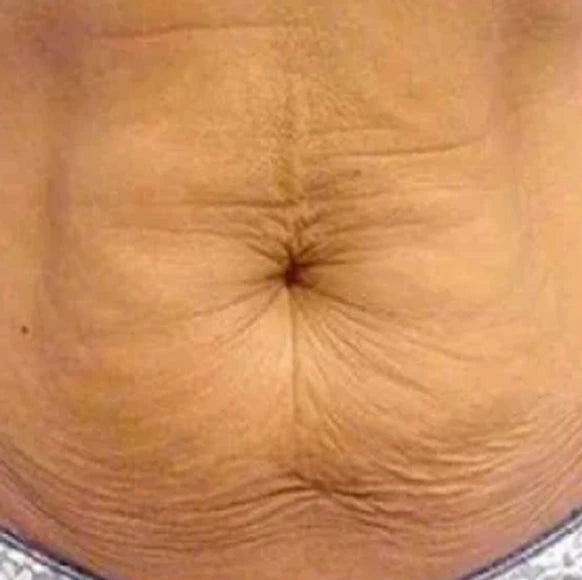 Before - Valentina P.