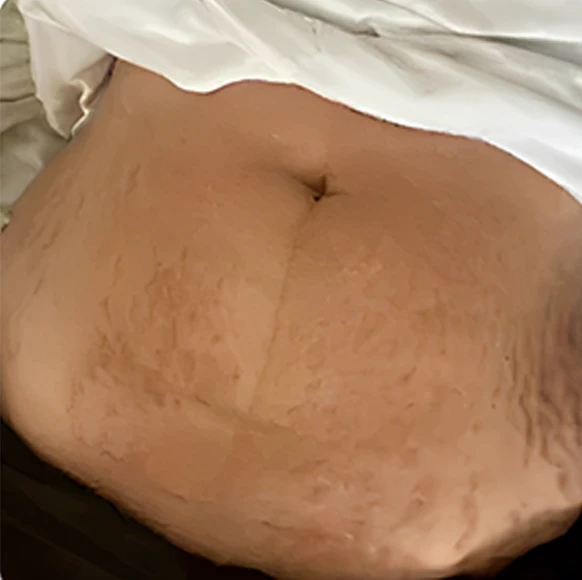 Before - Isabella M.